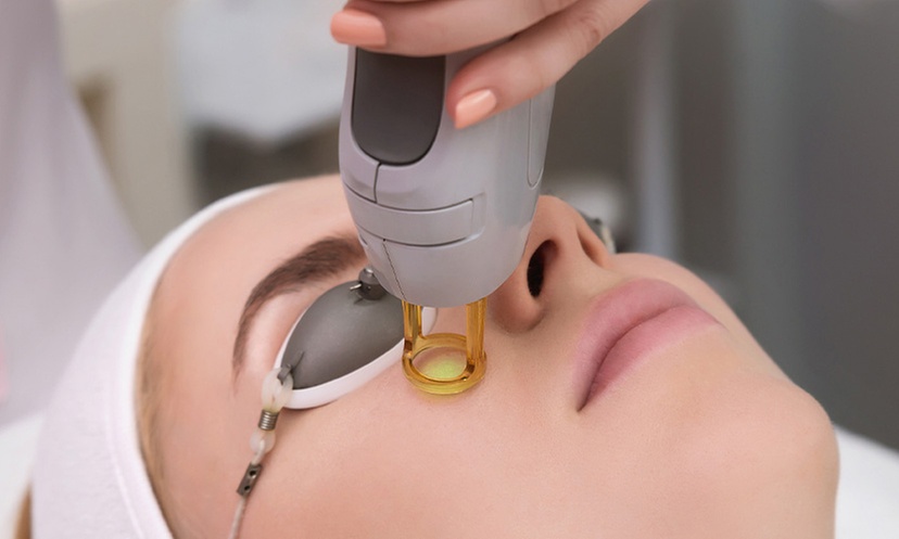 Experience Advanced Skin Rejuvenation With Fractional Laser Treatments