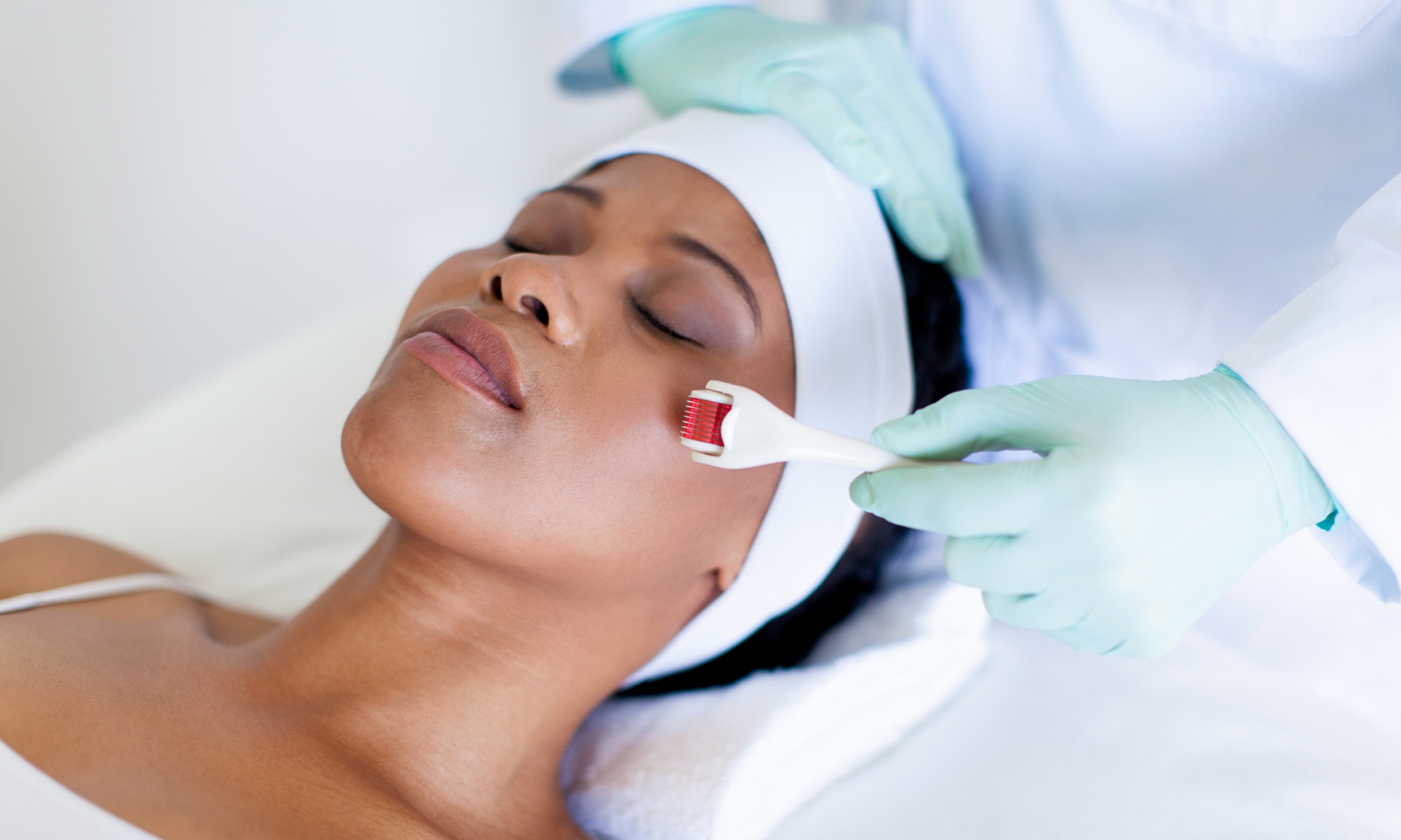 Microneedling Treatments: Deluxe, Medical, or Regular Options and More