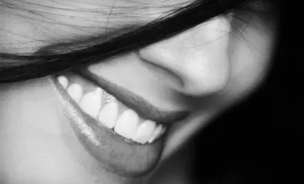 $149 for Teeth Whitening at Rochester Advanced Dentistry in Rochester ($500 Value) - Primary Image