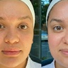Image 2: One HydroDiamond™ Hydrodermabrasion with Optional Add-On LED Treatment