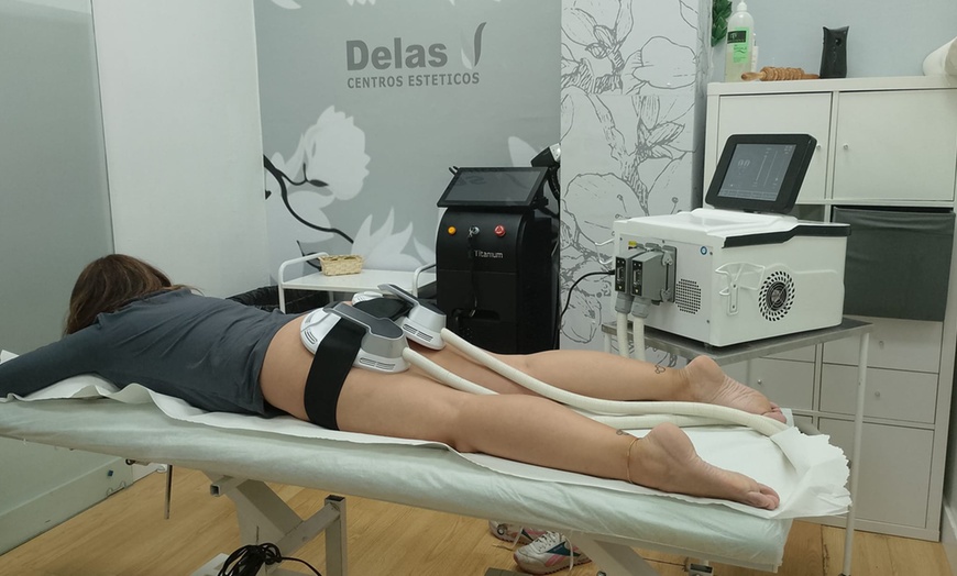 Image 1: Sesiones de tratamiento con EMSculpt en Delas Centro Médico Estético