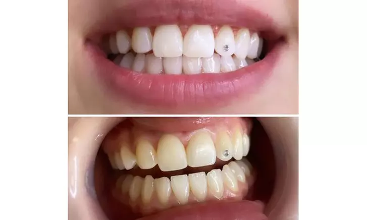 Bis zu 50% Rabatt auf den  bei Beauty By Gul