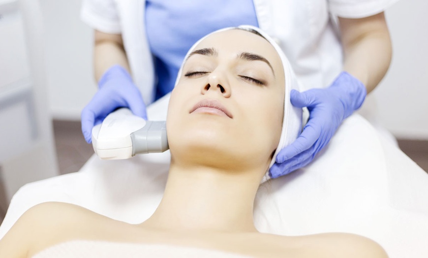 Image 10: 1 o 3 sesiones de IPL facial para revitalizar o atenuar manchas