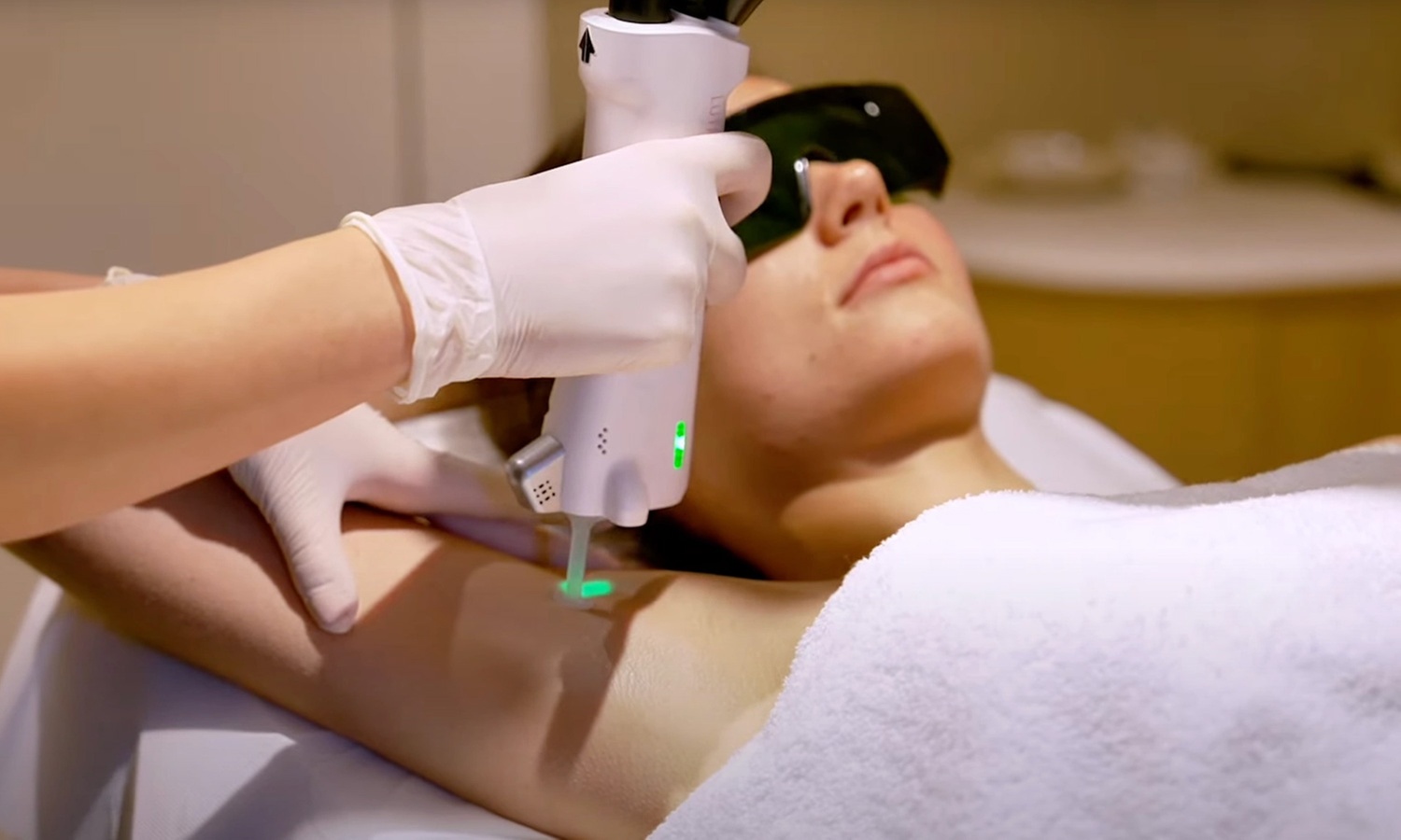 Dites adieu aux poils avec des séances ciblées d'épilation au laser