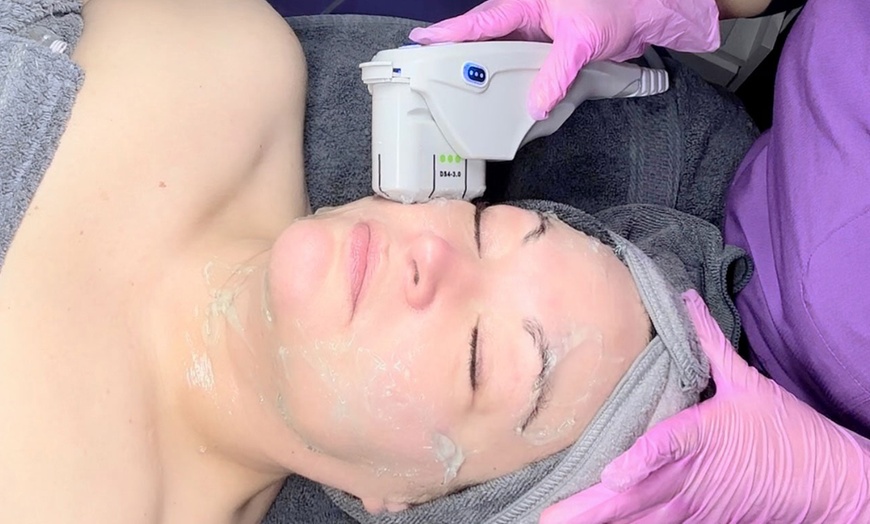 Image 1: Lift & Tighten Naturally – HIFU Facelift, One or Two Sessions
