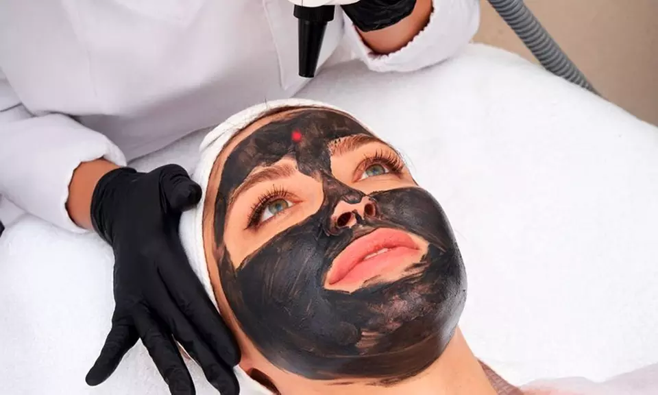 Higiene facial profunda con opción a peeling con láser o dermapen