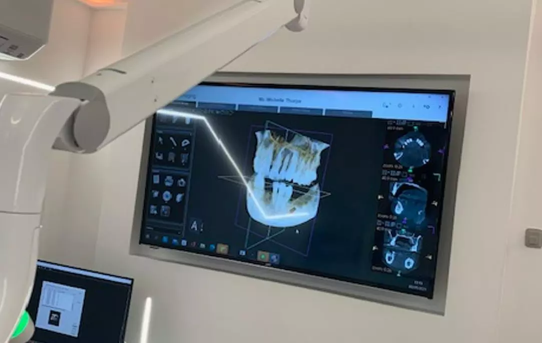 Up to 50% Off on Dental Checkup (Cleaning, X-Ray, Exam) at Dentspa Dental Health