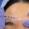 Image 1: 42% Off Xeomin + Belotero at One Beauty Aesthetics
