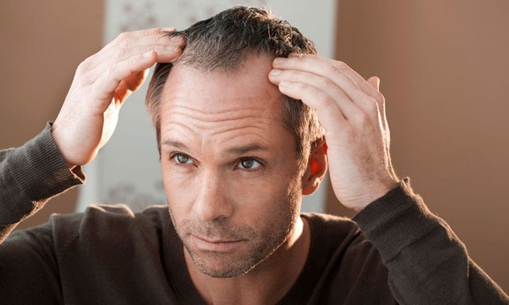 3 o 6 sesiones de bioestimulación plaquetaria capilar o facial