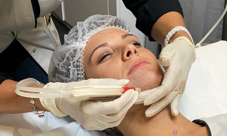 1 ou 2 soins du visage par microdermabrasion dès 24 € au Centre Esthétique Paris 8