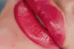Enhance Your Lips with Lip Blush Semi Permanent (Pmu) at Melt Spa -  40% Off - Second Medium
