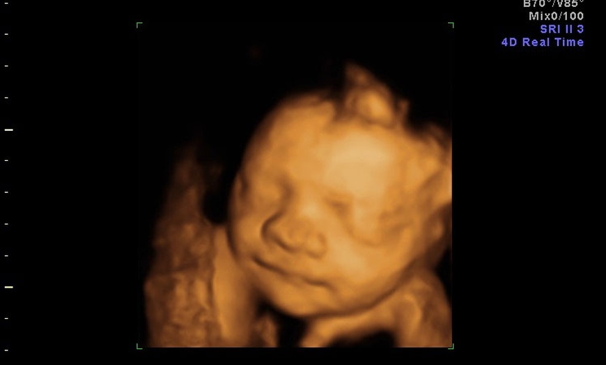 Image 5: 3D/ 4D Baby Scan