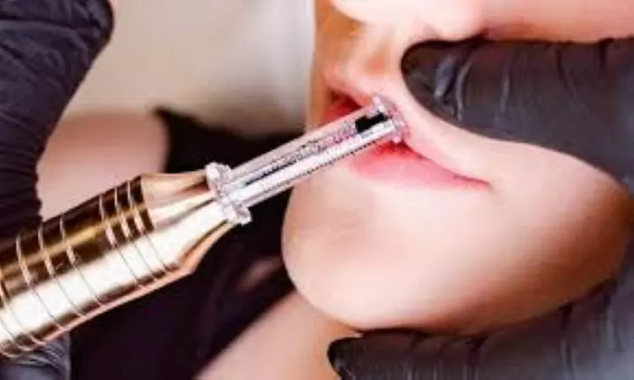 One or Two HyaPen Needle-Free Lip Enhancement  Sessions at Luxe Glamour Lounge (Up to 49% Off) - Primary Image