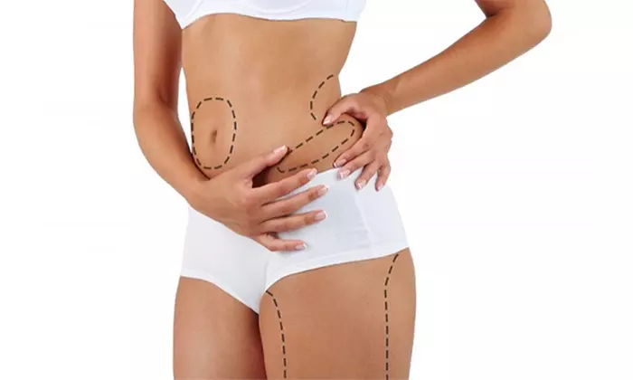 Up to 67% Off on  at Venus Medical Spa - Primary Image