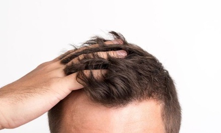 Tratamiento capilar con mesoterapia: 6 sesiones - Ticap Clinics