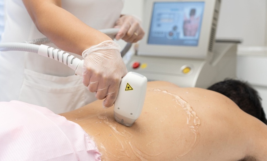Image 4: Up to 50% Off on Laser Hair Removal at Radiant Touch Skin Care Bar