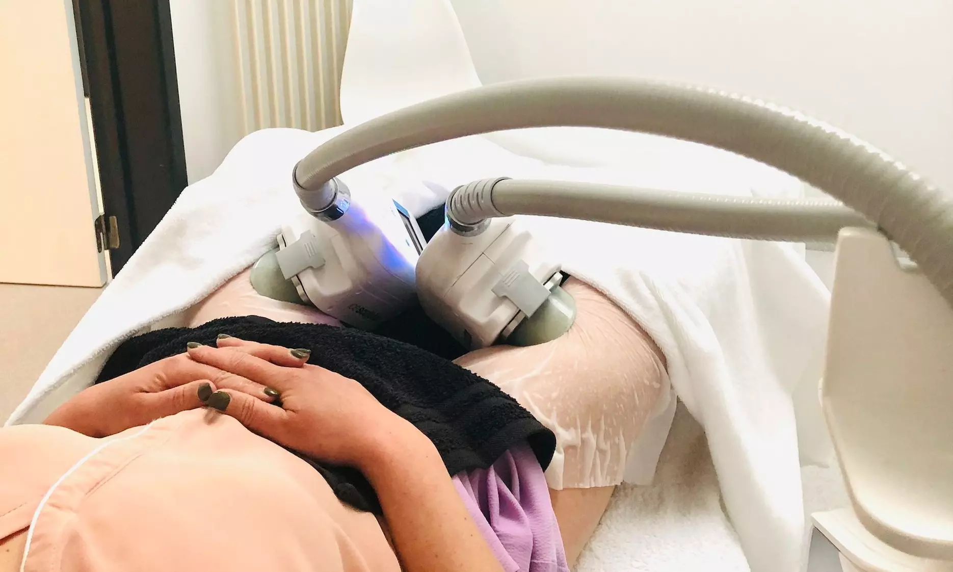Cryotherapy behandeling Mechelen
