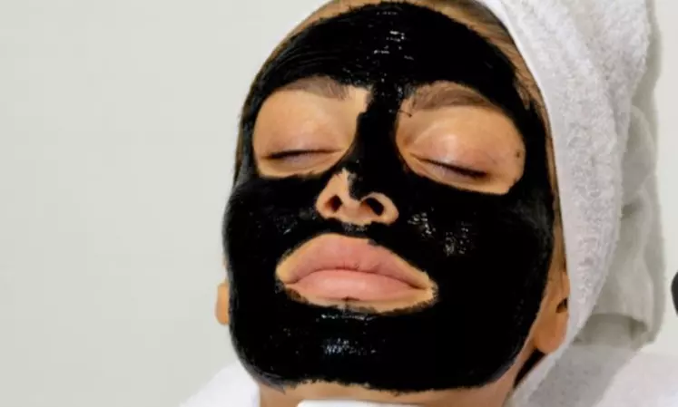 Tratamiento facial Hollywood Peel en Raquel Gallardo Alarcon