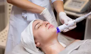 Elige entre punta de diamante, fototerapia, ultrasonidos y maderoterapia en Silueta & Rostro con65% de descuento