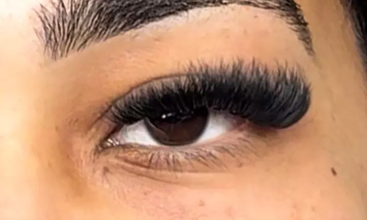 Achieve Glamour with  Full Set of Classic, Volume, Mega Eyelash Extensions w/ Two Week Fill- Up to 50% Off - Second Medium