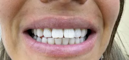 Bis zu 53% Rabatt auf den  bei SKBeauty