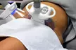 Zabieg wyszczuplającej kriolipolizy od 139,99 zł w Instytucie Urody Fantastic Body - Second Medium
