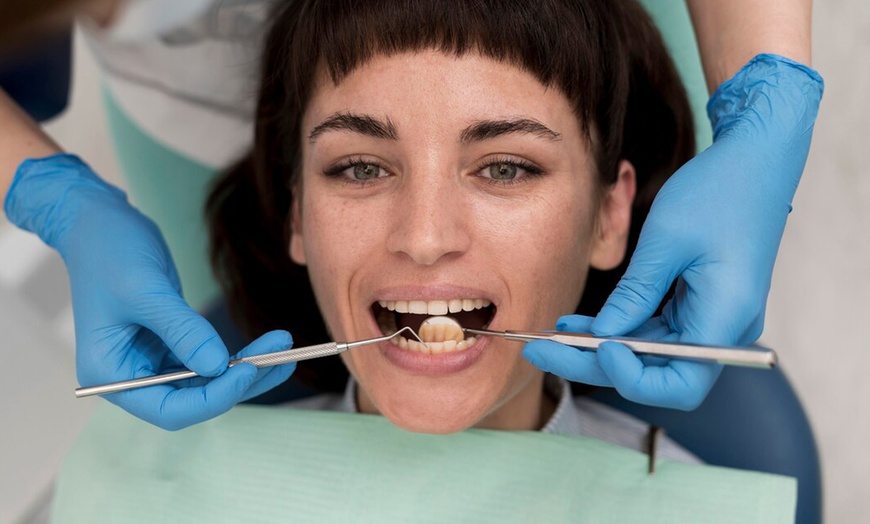 Image 5: Limpieza bucal con radiografía y opción a curetaje de 1 o 2 arcadas