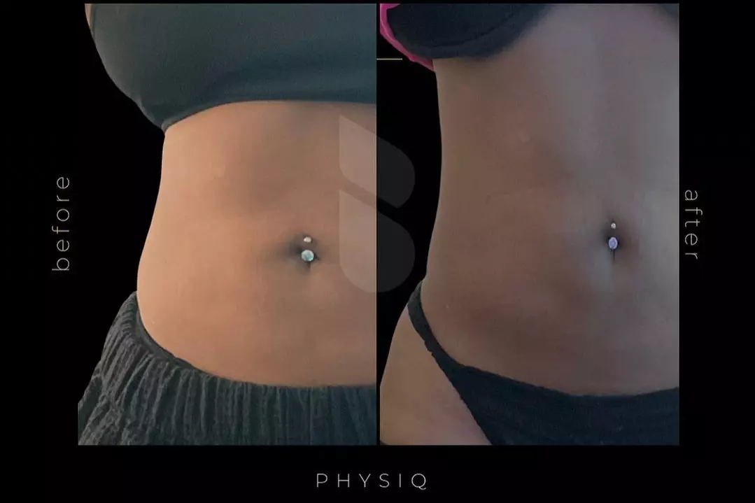 Up to 83% Off on Electrical Muscle Stimulation at The Bodie Co