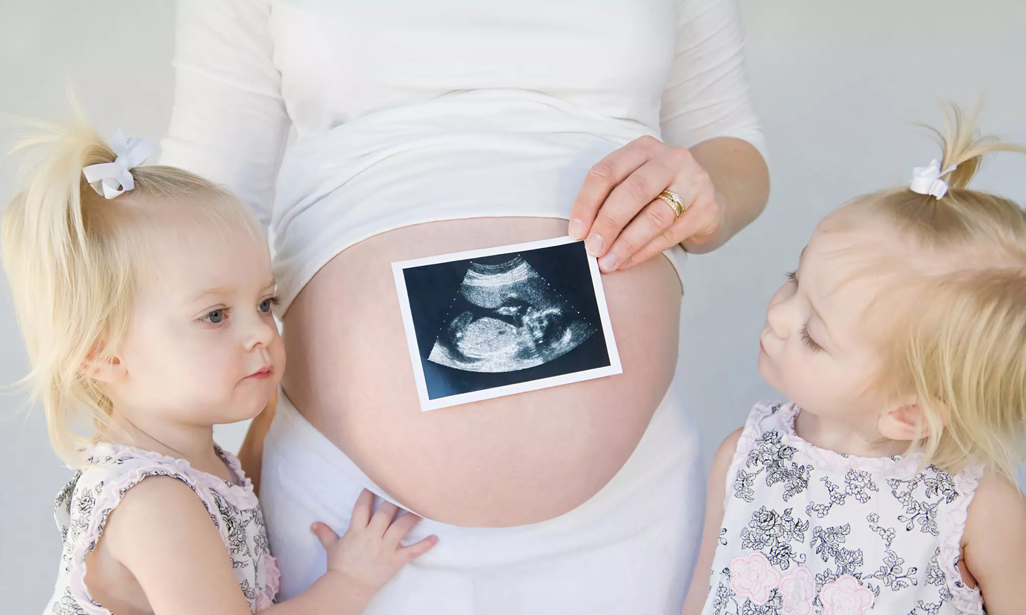 Baby Gender Scan with 4D Sneak Peek at Ultrasound Plus – Professional Pregnancy Imaging – Up to 35% Off - Primary Image