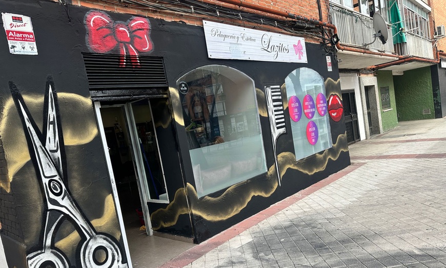 Image 5: 3, 5 o 7 sesiones de depilación con láser XHR en zona a elegir