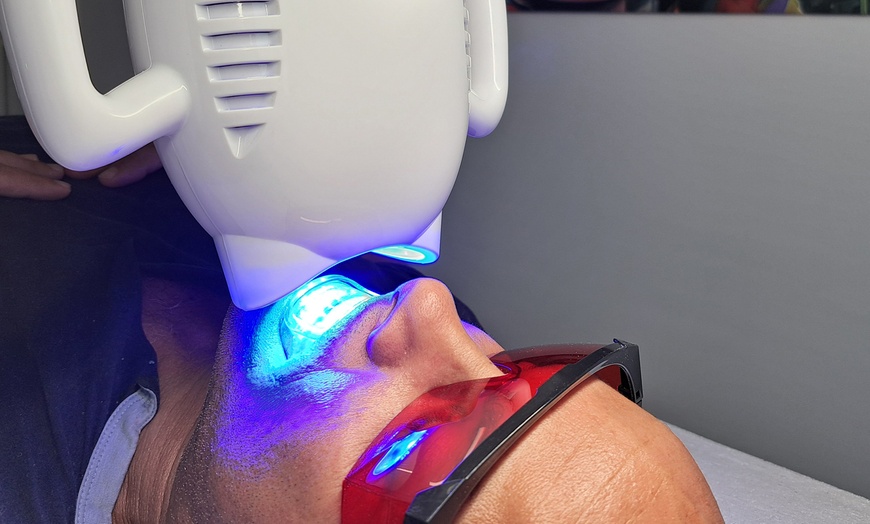 Image 2: 1 ou 2 séances de blanchiment dentaire avec Beauty Face By Lara