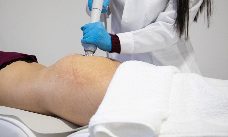 Image 2: Presoterapia y ondas de choque