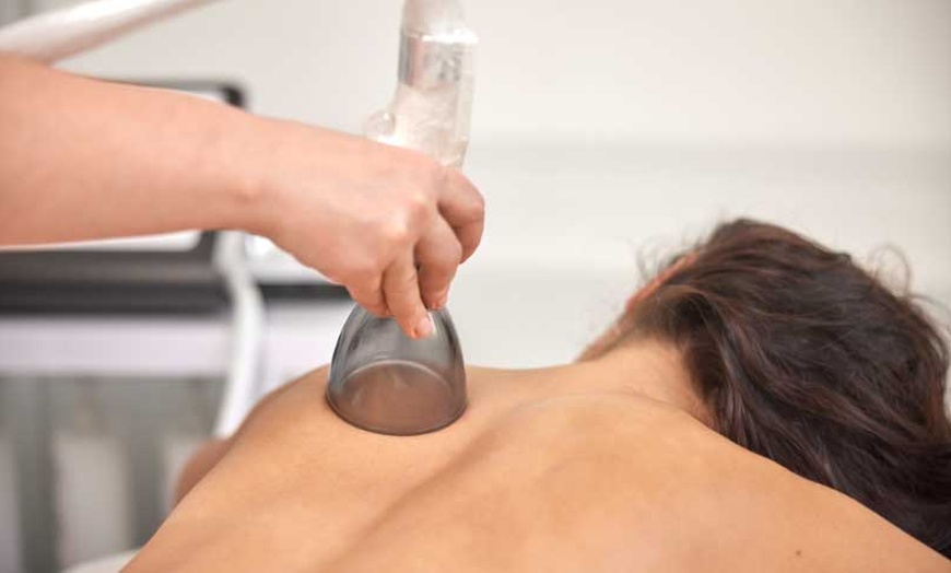 Image 1: Lymphatic Drainage Micro Cupping Massage at Designing Faces Ink