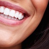 Image 3: Revitalize Your Smile with Professional Teeth Whitening Options