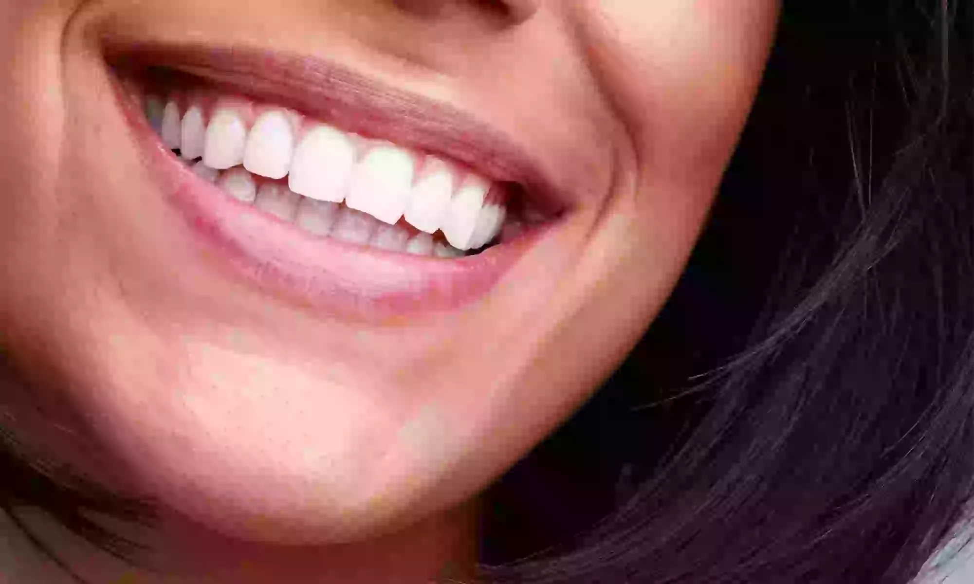 Revitalize Your Smile with Professional Teeth Whitening Options