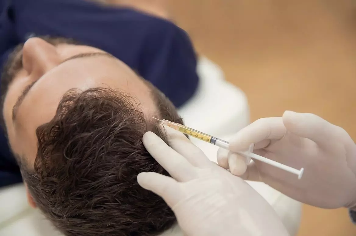 One or Three essions of 60-Min PRP Hair Restoration (PRP)