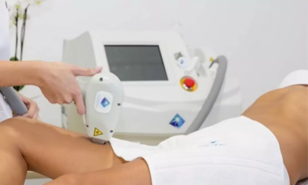 Depilación con láser de diodo en una zona a elegir para 1 persona