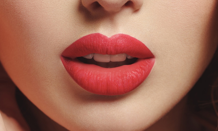 Image 2: Mesotherapy for Lip Volume at Miami Kiss