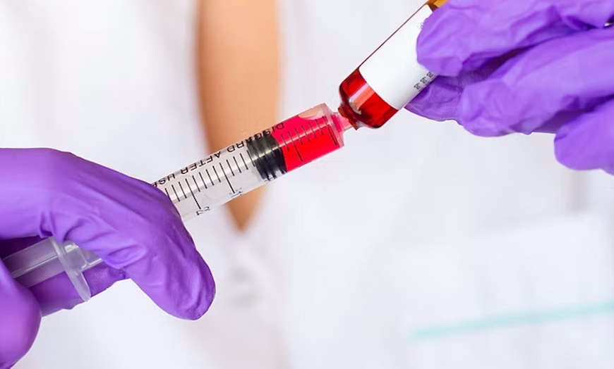 Image 2: Enhance with 0.5ml, 1ml, or 2ml Dermal Filler with a Consultation 