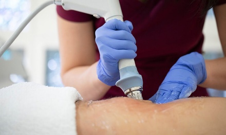 6 sesiones de 25 minutos de tratamiento HIFU 7D en una zona a elegir - The Look Madrid