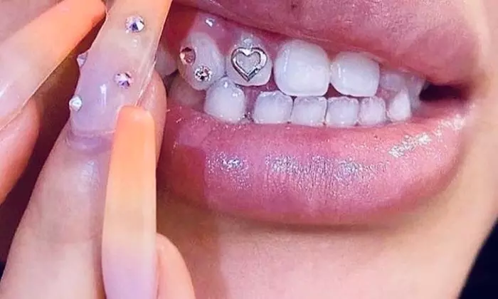 Up to 71% Off on Teeth Whitening at The Glo Up Spa - Second Medium