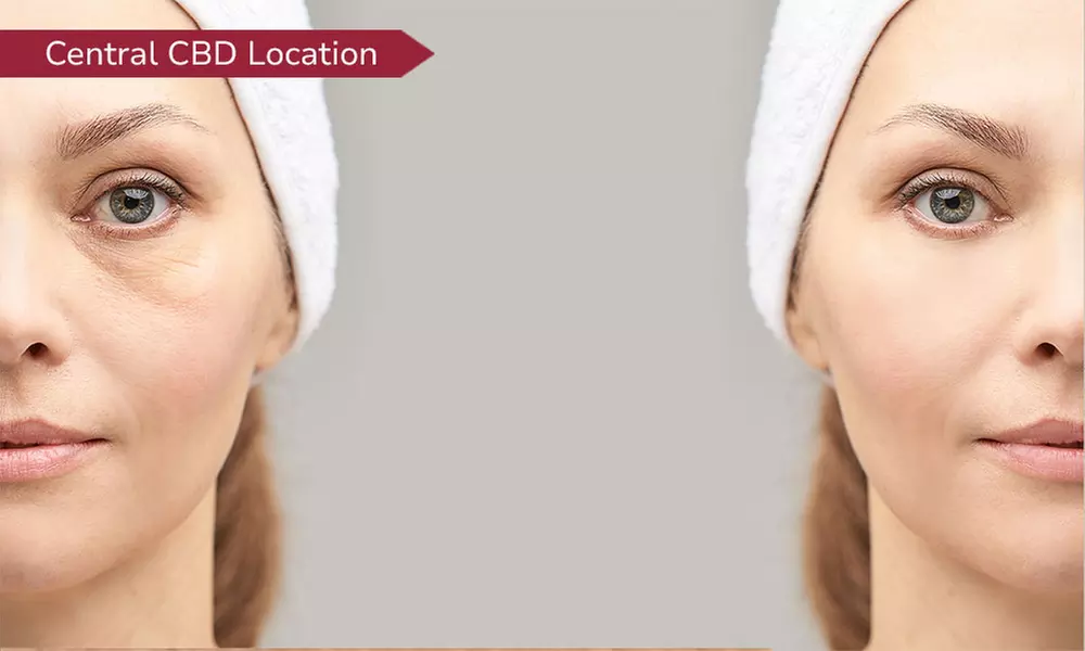 Full-face Fractional Laser Treatment at La Belle Beauty and Laser Clinic (Up to 62% Off) - Primary Image