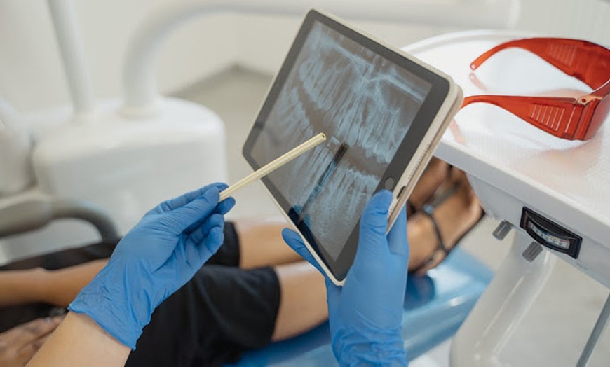 Image 1: Limpieza dental, con revisión, radiografía y 1 blanqueamiento led