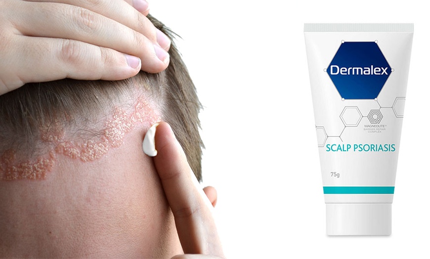 Image 2: Dermalex Scalp Psoriasis Treatment Gel 75g