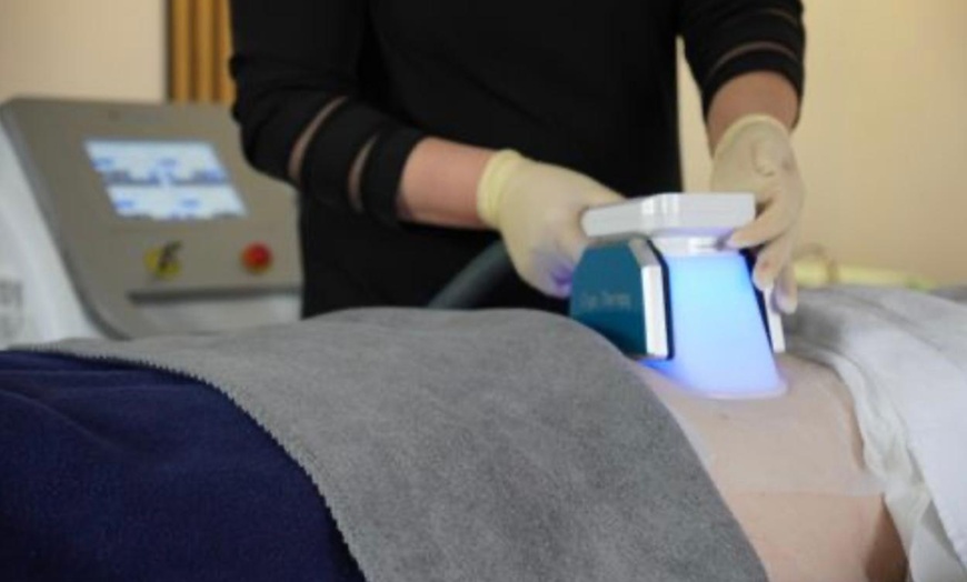 Image 1: Bis zu 69% Rabatt auf Kyrolipolyse-Behandlung