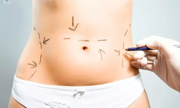 Mesoterapia corporal inyectada: 4 u 8 sesiones personalizadas