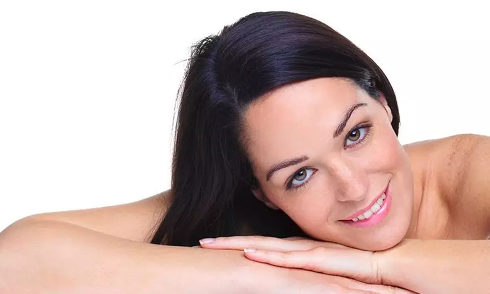 $249 for Clear + Brilliant Full Face Treatment at Cara Mia Medspa ($399 Value) - Primary Image