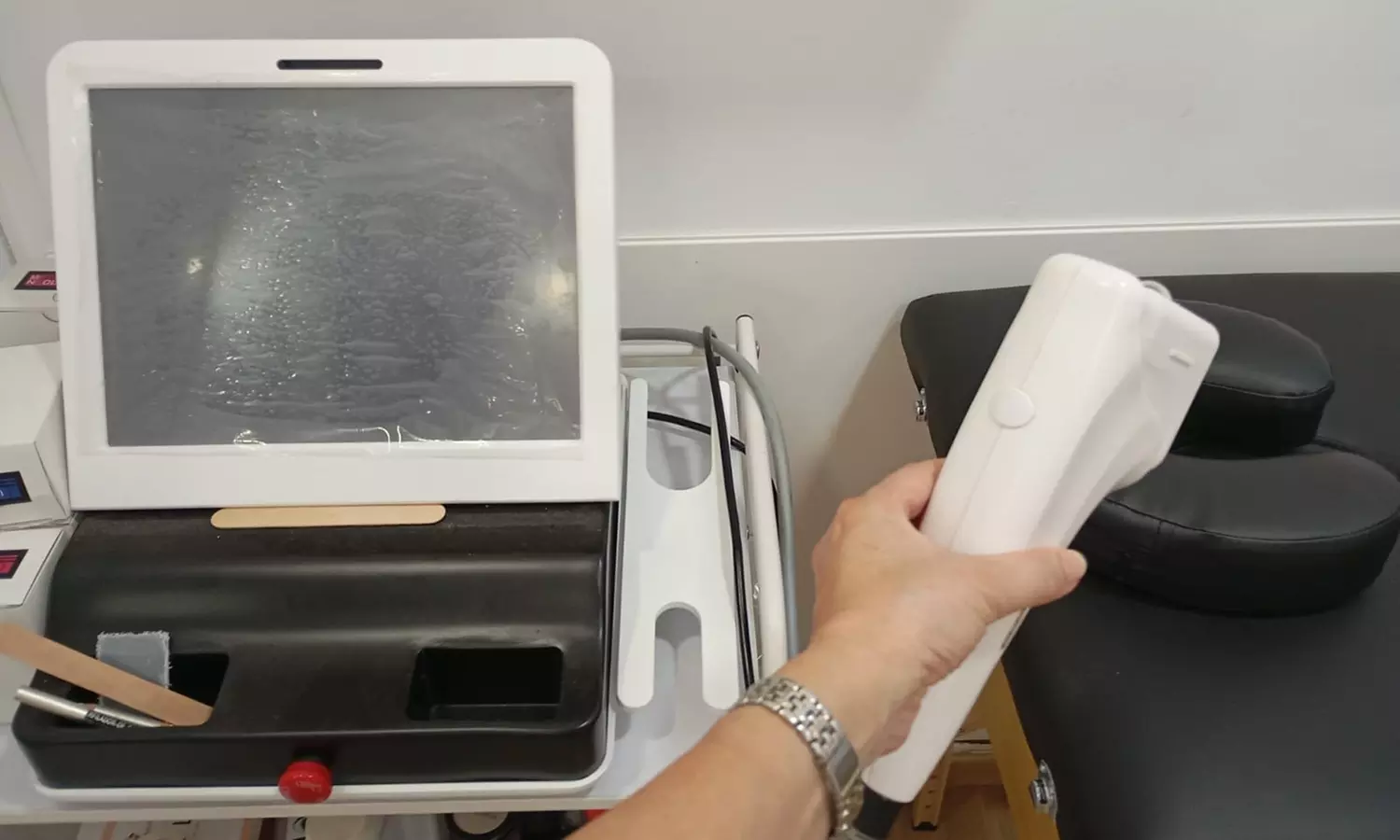 Sesión de tratamiento HIFU efecto lifting en rostro, cuello y papada