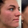 Image 2: Choice of Facial- Classic, Microdermabrasion, or More 