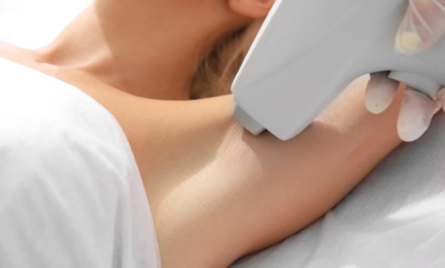 Image 3: 3 oder 5 Sessionen Laserhaarentfernung an einer kleinen / großen Zone